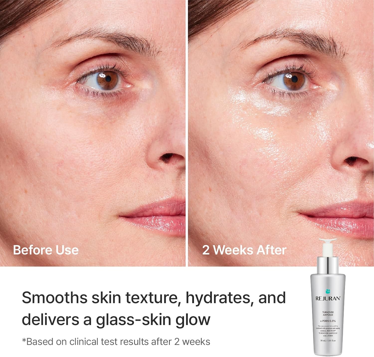 REJURAN Turnover Ampoule, c-PDRN Face Serum for Youthful Glow for Glass Skin - 30ml